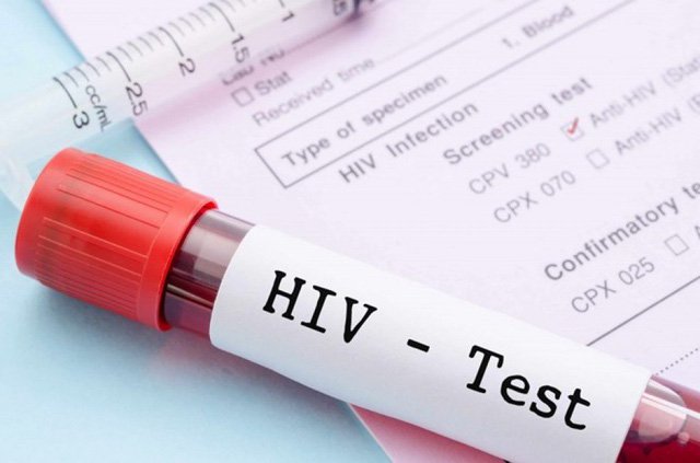 Các phương pháp xét nghiệm HIV thường dùng nhất - Bs Thế